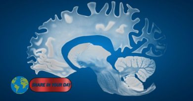 Male Brains Shrink Faster Than Female Brains, Study Finds
